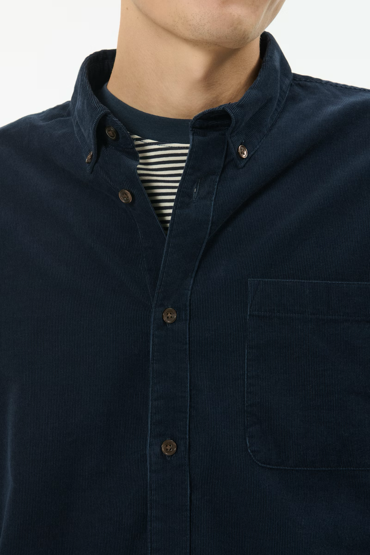 MAtrostol BD - 30208772